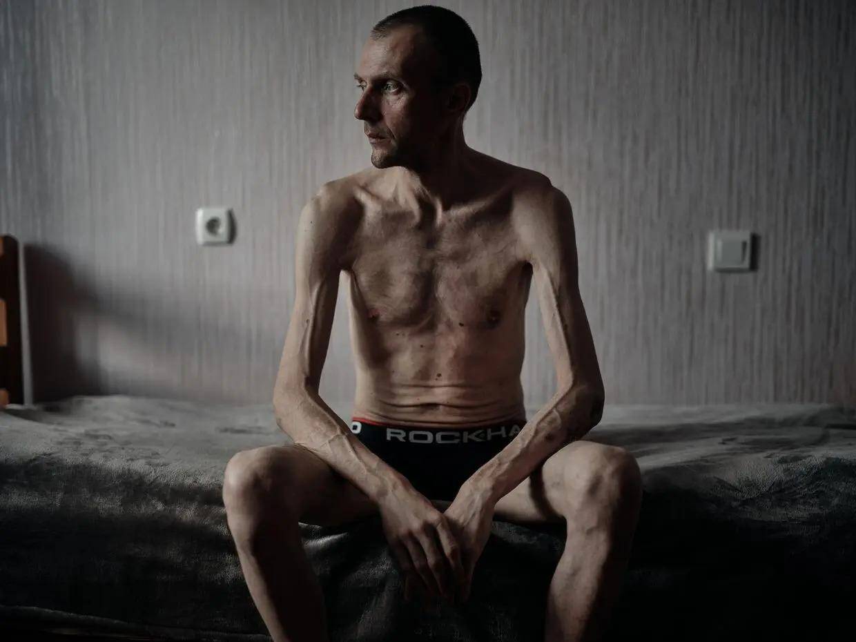 A Ukrainian soldier who returned from Russian captivity is photographed while undergoing rehabilitation in an unspecified location in Ukraine, summer 2025